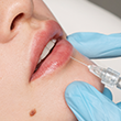Lip Surgery